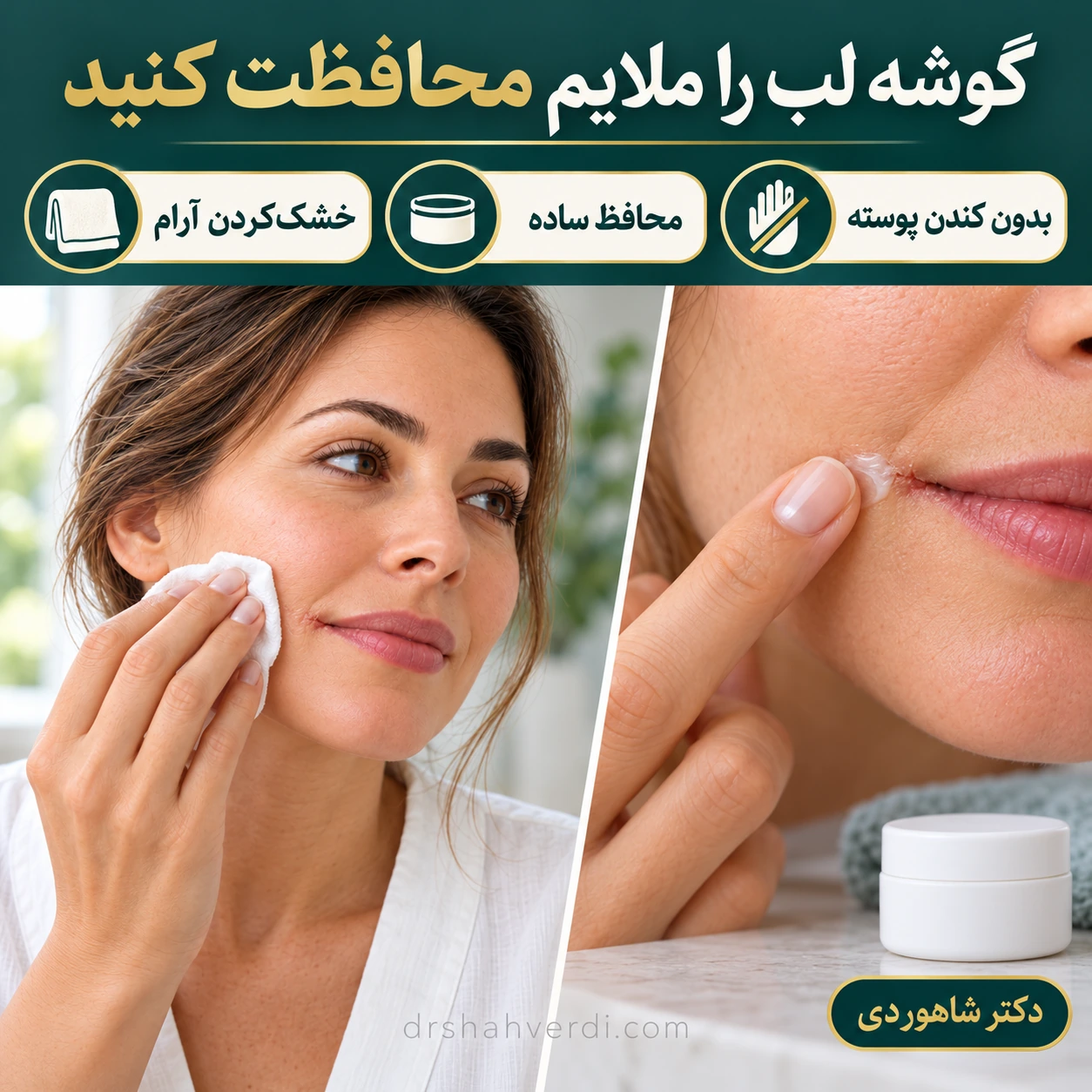 دو نمای پارچه نرم روی گونه کنار دهان و مقدار کمی محافظ ساده روی پوست بیرونی کنار ترک گوشه لب