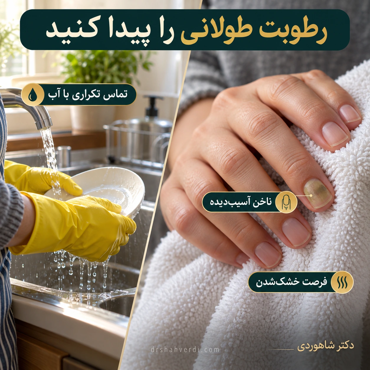 پایان کار با آب و خشک‌کردن آرام انگشت دارای تغییر رنگ ناخن
