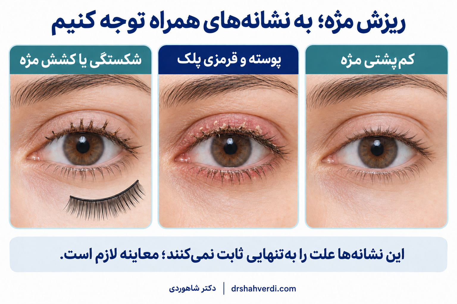 تصویر آموزشی کم‌پشتی مژه، پوسته و قرمزی لبهٔ پلک و شکستگی یا کشش مژه