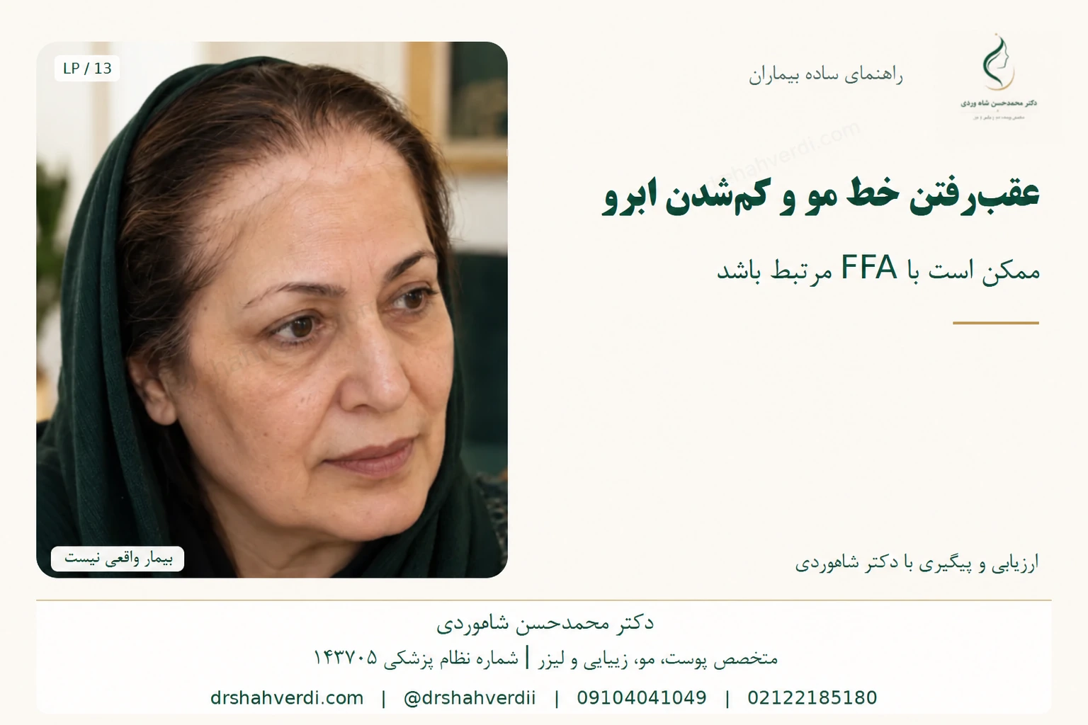 خط رویش پیشانی و ابروی کمپشت زن بزرگسال