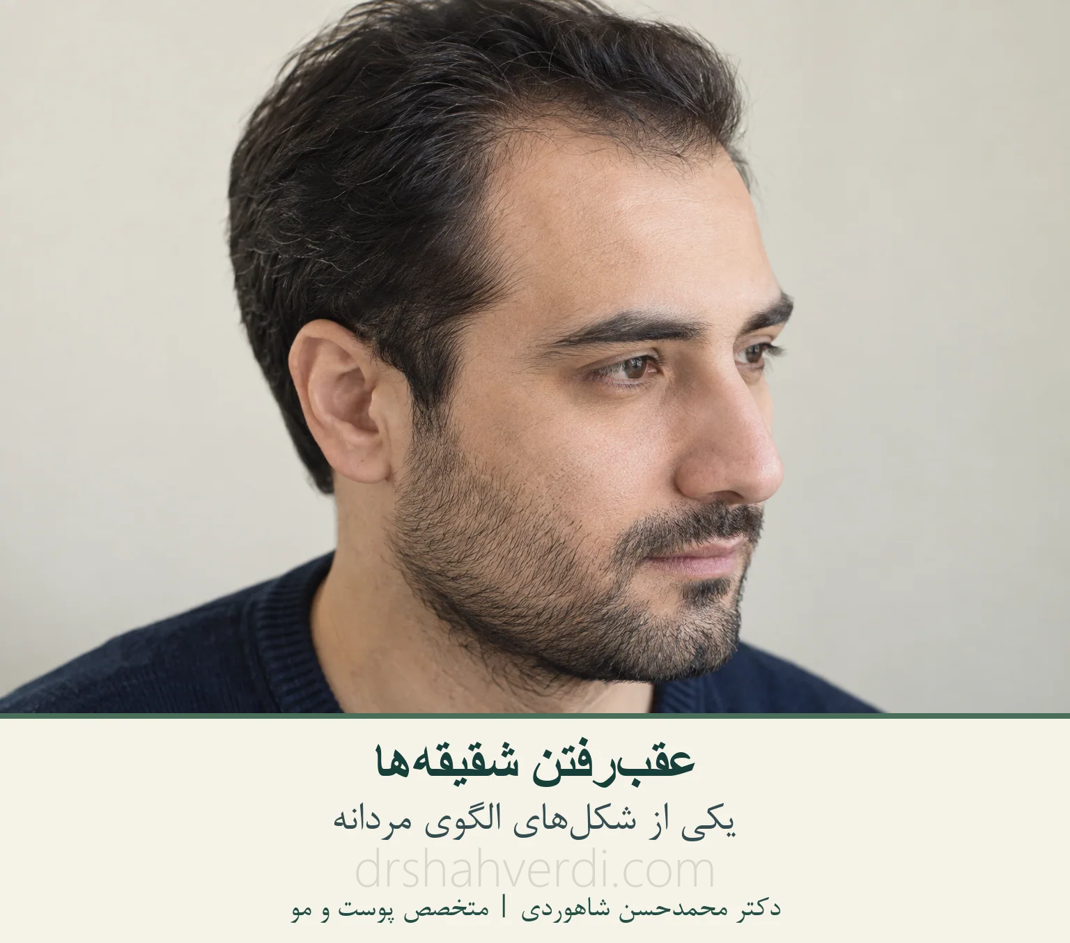 کم‌پشتی شقیقه در یک مرد بزرگسال