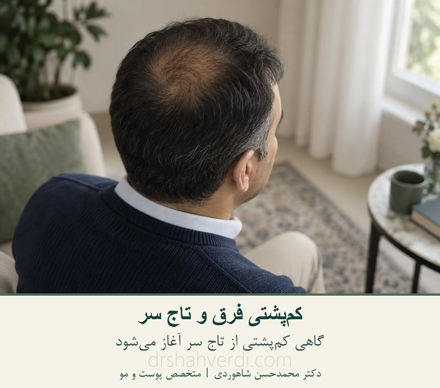 نمای تاج سر برای توضیح کم‌پشتی الگویی مردانه