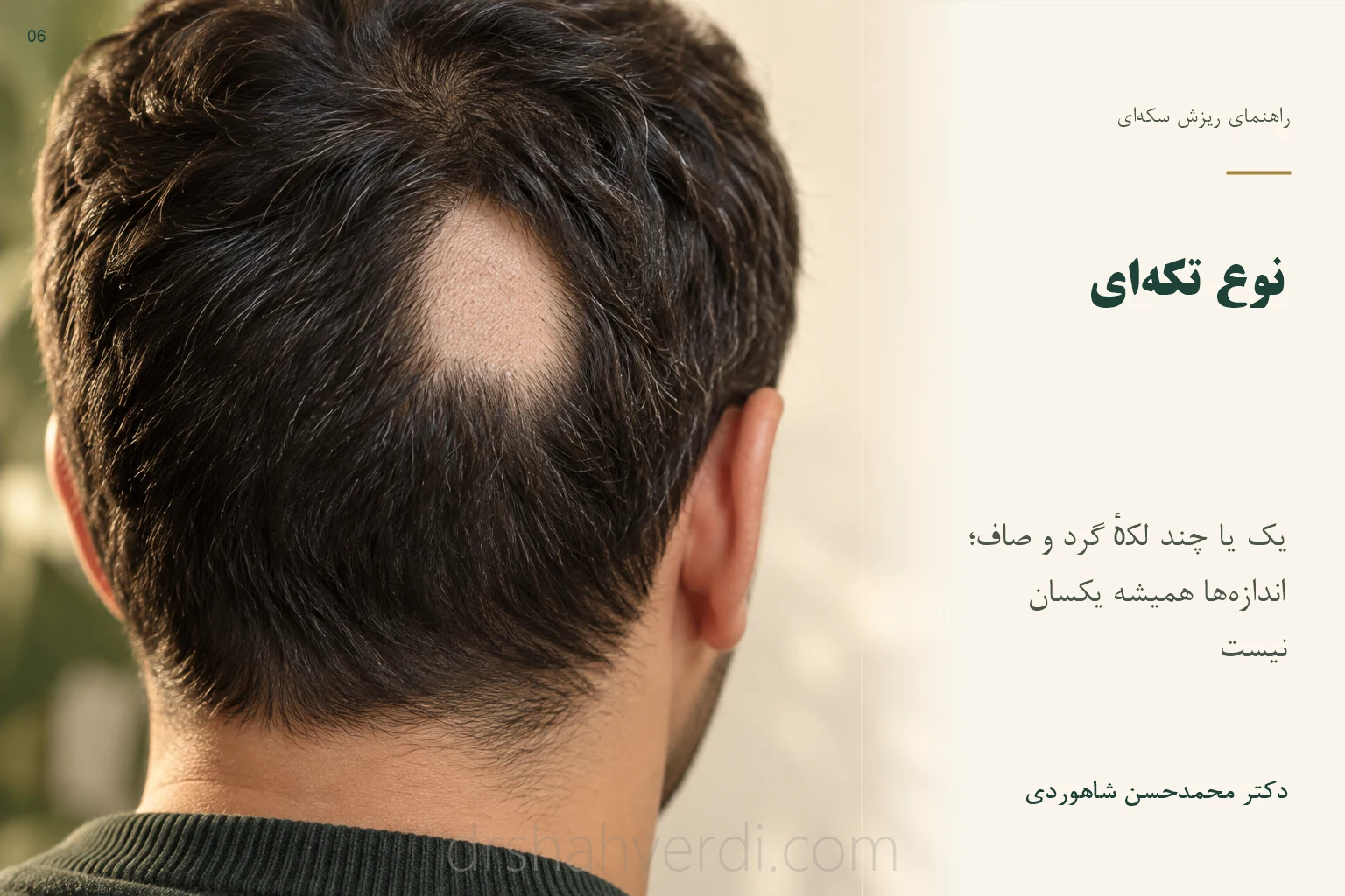 تصویر نوع تکهای؛ یک یا چند لکهٔ گرد و صاف؛ اندازهها همیشه یکسان نیست تصویر نوع تکهای؛ یک یا چند لکهٔ گرد و صاف؛ اندازهها همیشه یکسان نیست