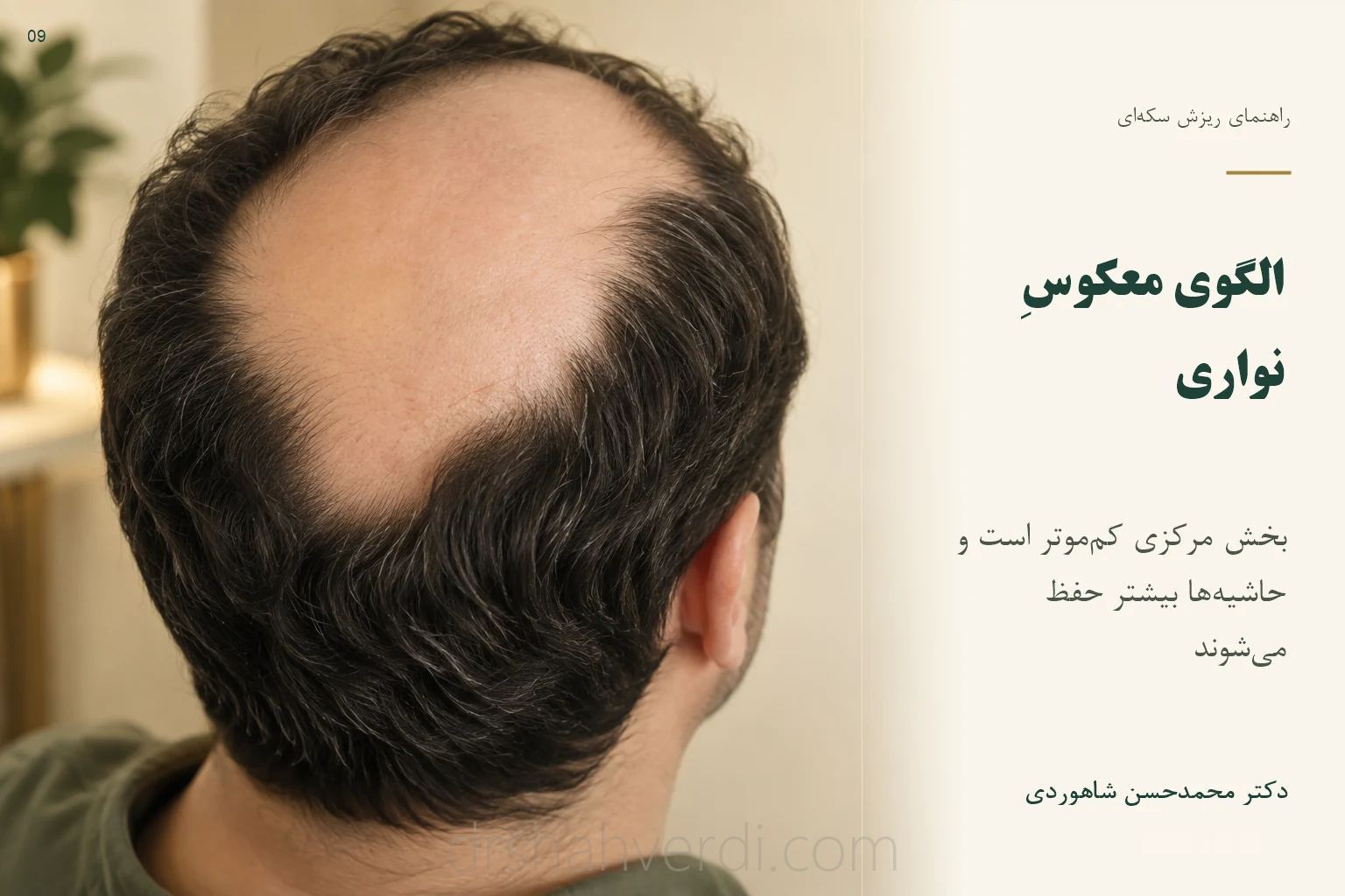 تصویر الگوی معکوسِ نواری؛ بخش مرکزی کمموتر است و حاشیهها بیشتر حفظ میشوند تصویر الگوی معکوسِ نواری؛ بخش مرکزی کمموتر است و حاشیهها بیشتر حفظ میشوند
