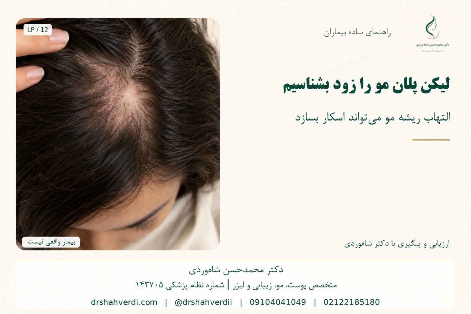 نمای نزدیک ناحیه کممو و پوست سر