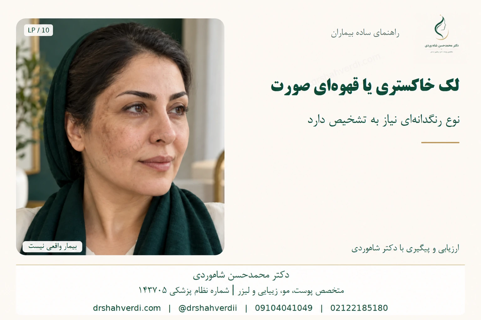 لکهای خاکستری قهوهای روی صورت زن بزرگسال