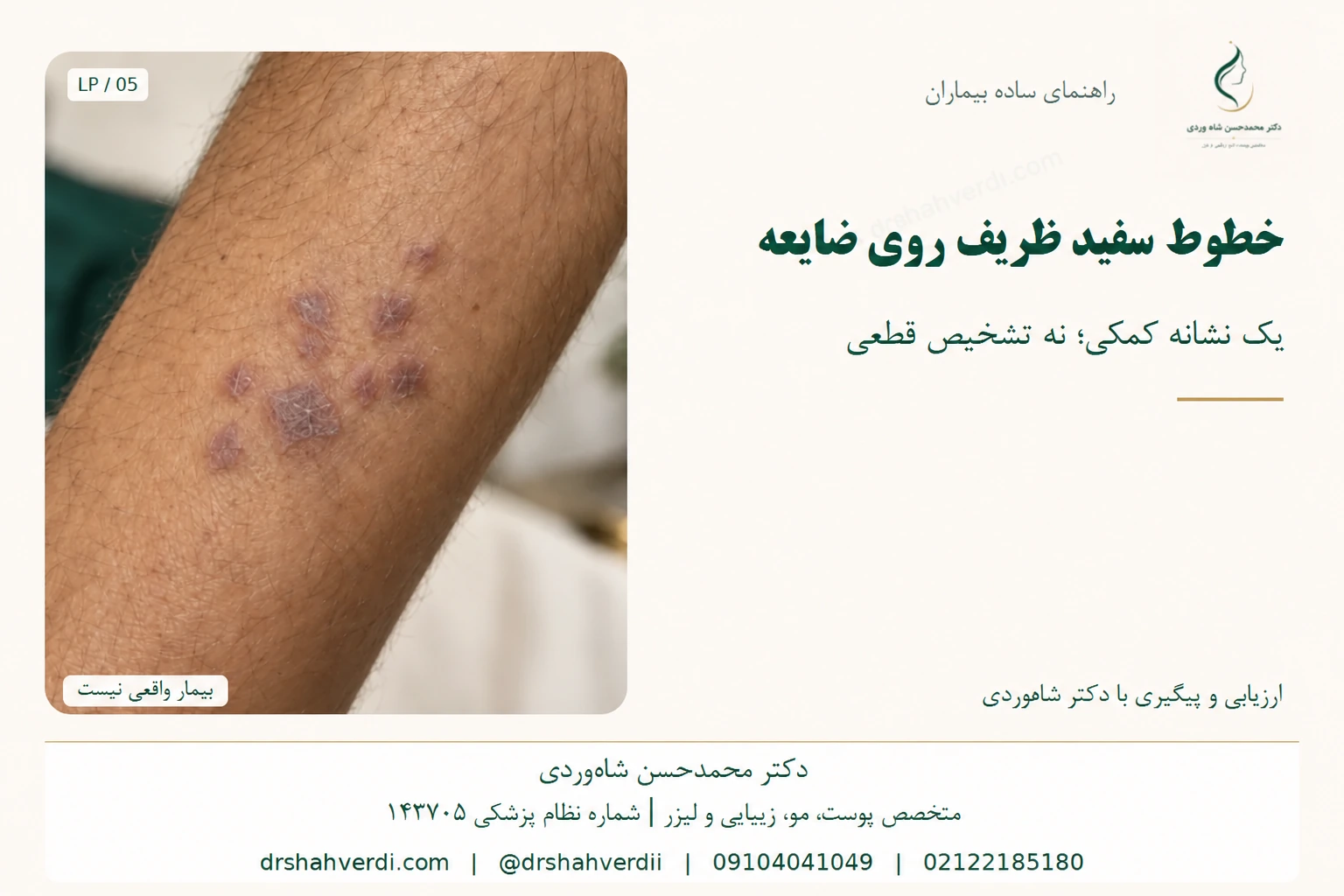 نمای نزدیک خطوط سفید ظریف روی دانه پوستی
