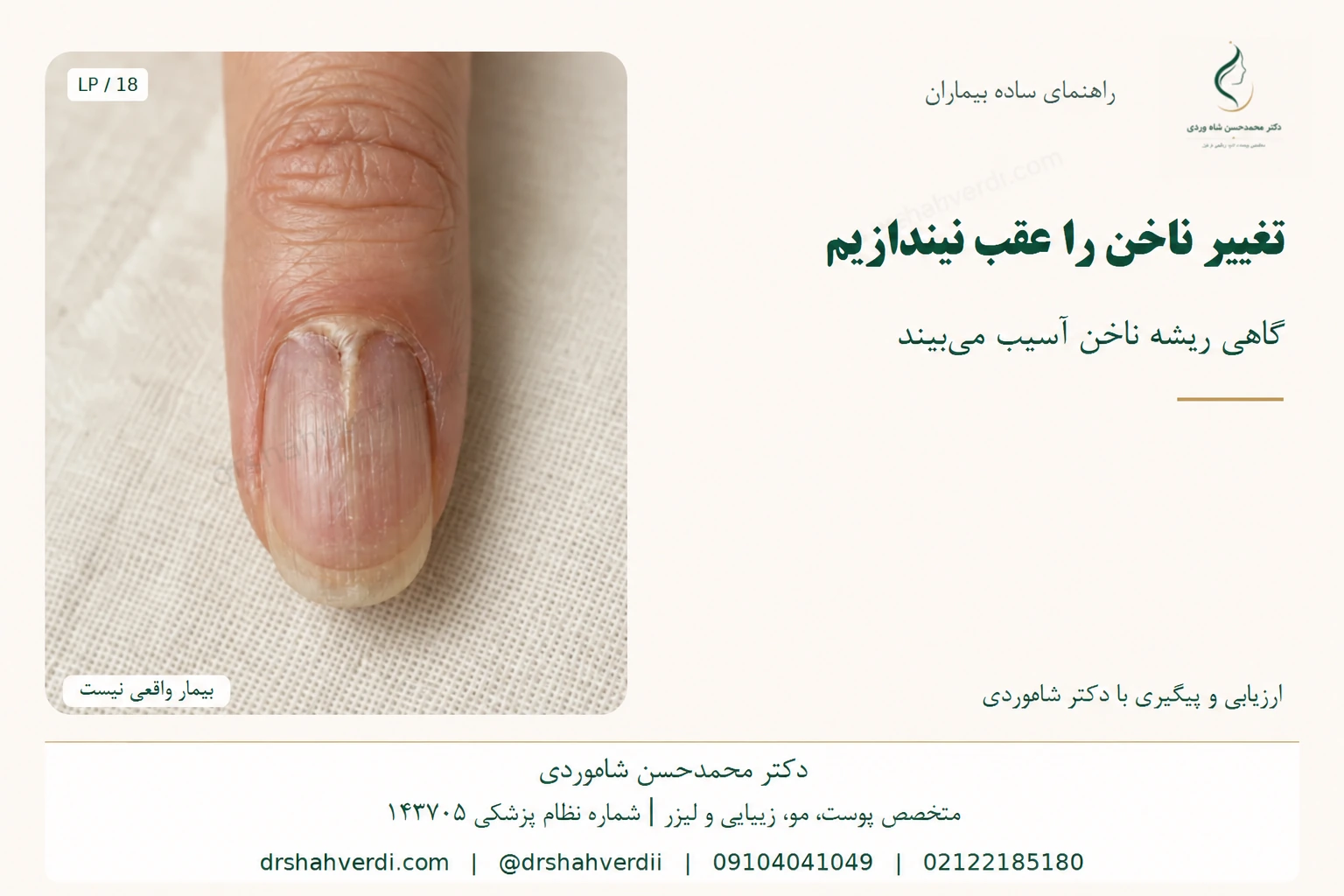 نمای تغییر ریشه و صفحه ناخن