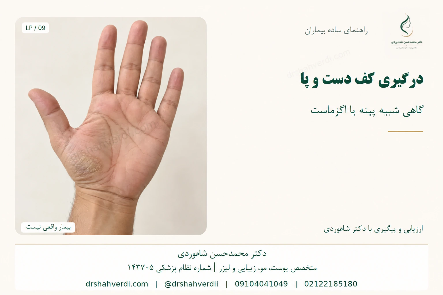 نمای کف دست با تغییرات پوستهدار