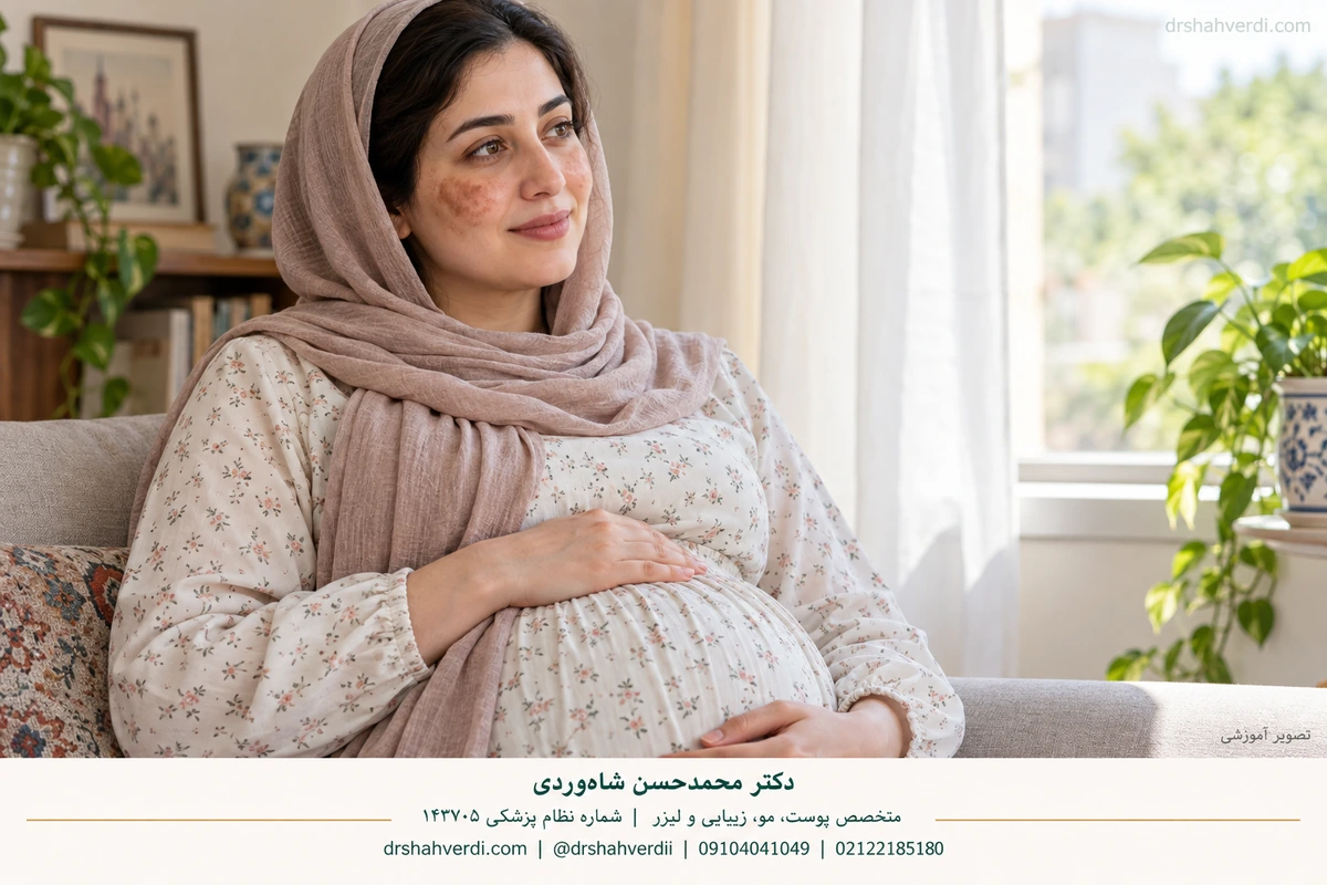مدل باردار آموزشی با تیرگی ملایم گونه