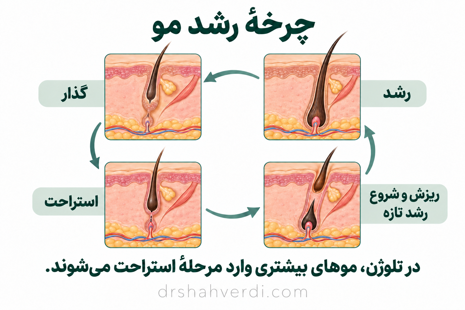چهار مرحلهٔ رشد، گذار، استراحت و رهاشدن موی قدیمی همراه شروع رشد تازه در فولیکول